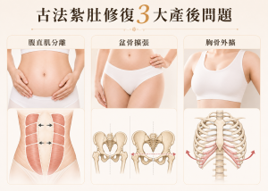 古法紮肚解決3大產後文題